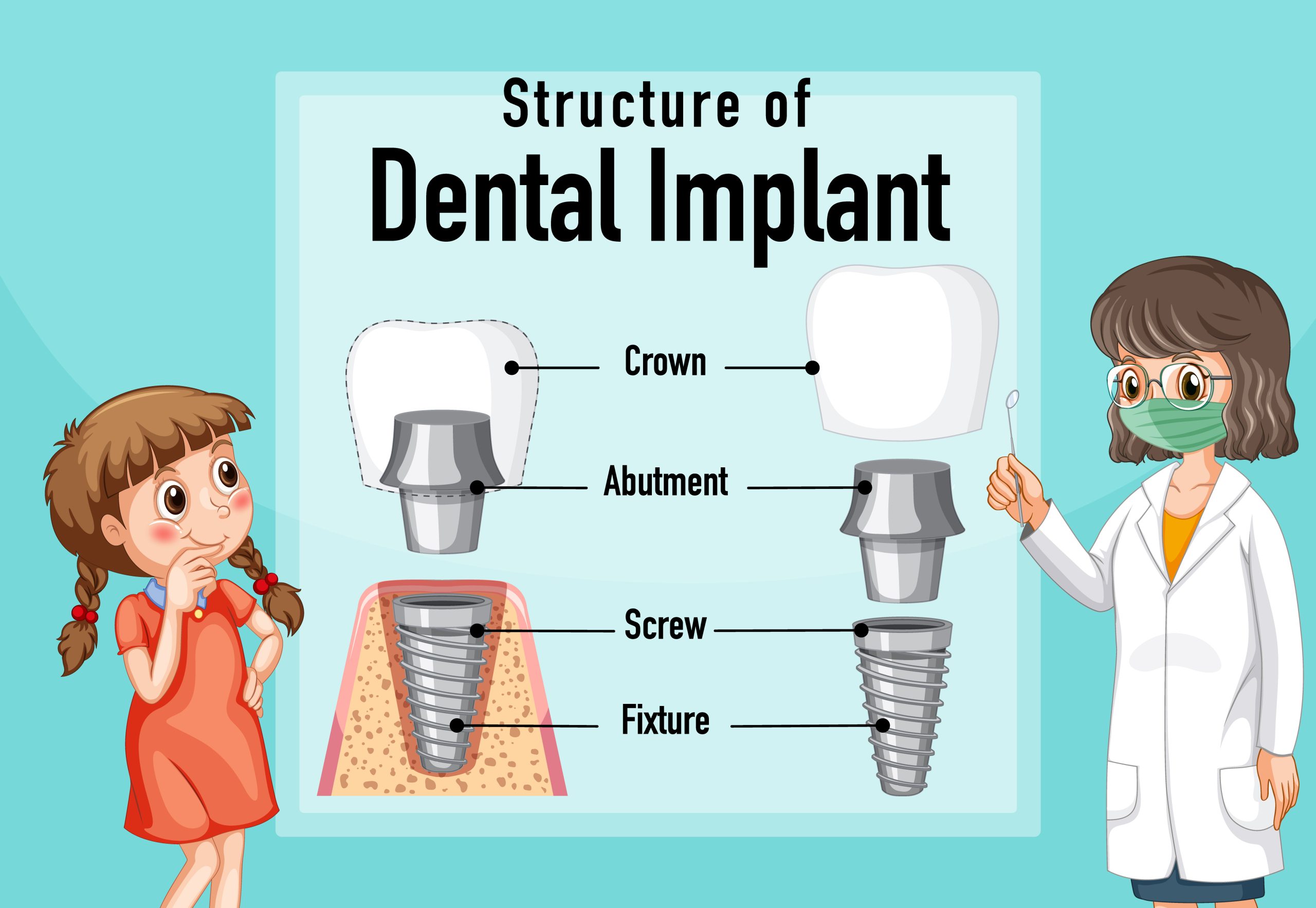 dental implants