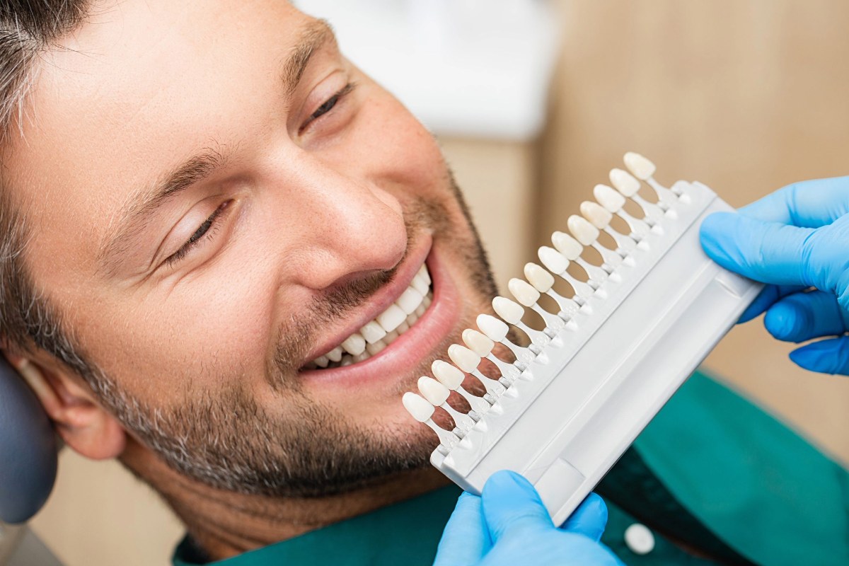 can veneers fix gaps or crooked teeth