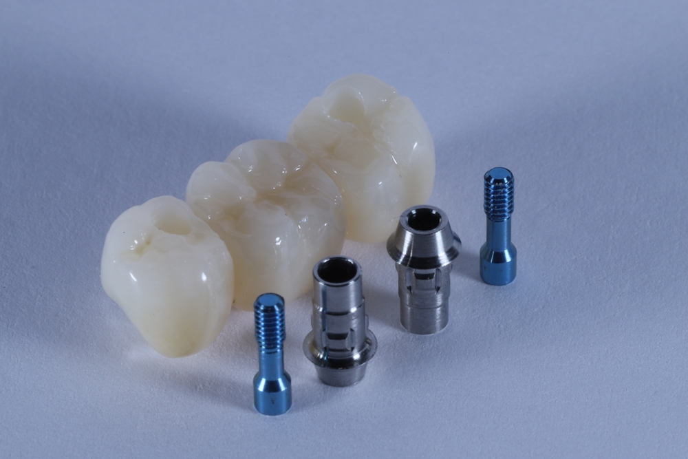 what is the difference between a bridge and an implant and which is the best option