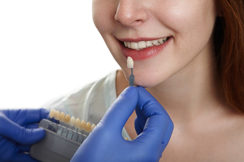 Can Porcelain Veneers Fix Worn-Down Teeth
